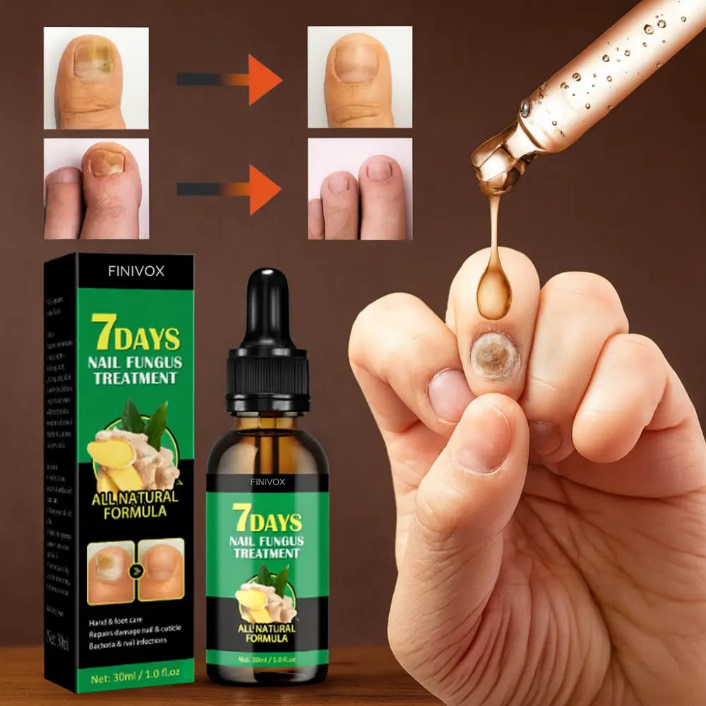7 Days Nail Fungus Treatment